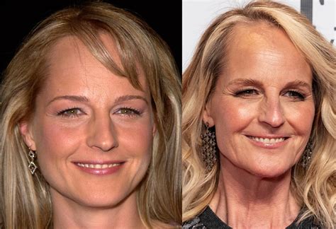 helen hunts facelift|helen hunt face today.